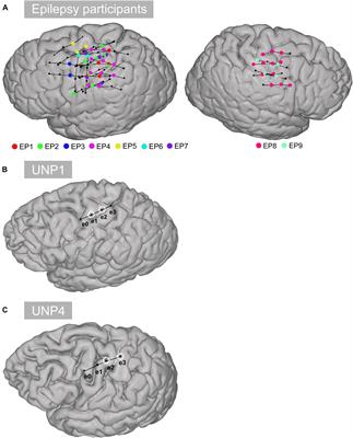 Sensorimotor ECoG Signal Features for BCI Control: A Comparison Between People With Locked-In Syndrome and Able-Bodied Controls